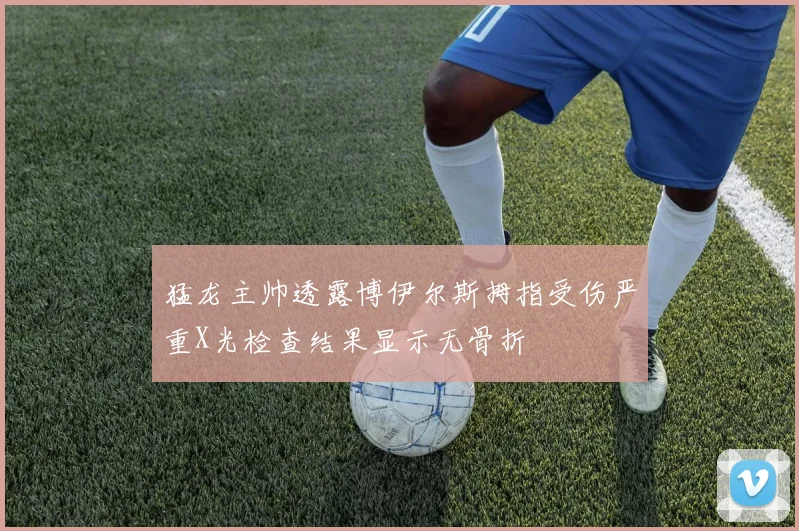 猛龙主帅透露博伊尔斯拇指受伤严重X光检查结果显示无骨折